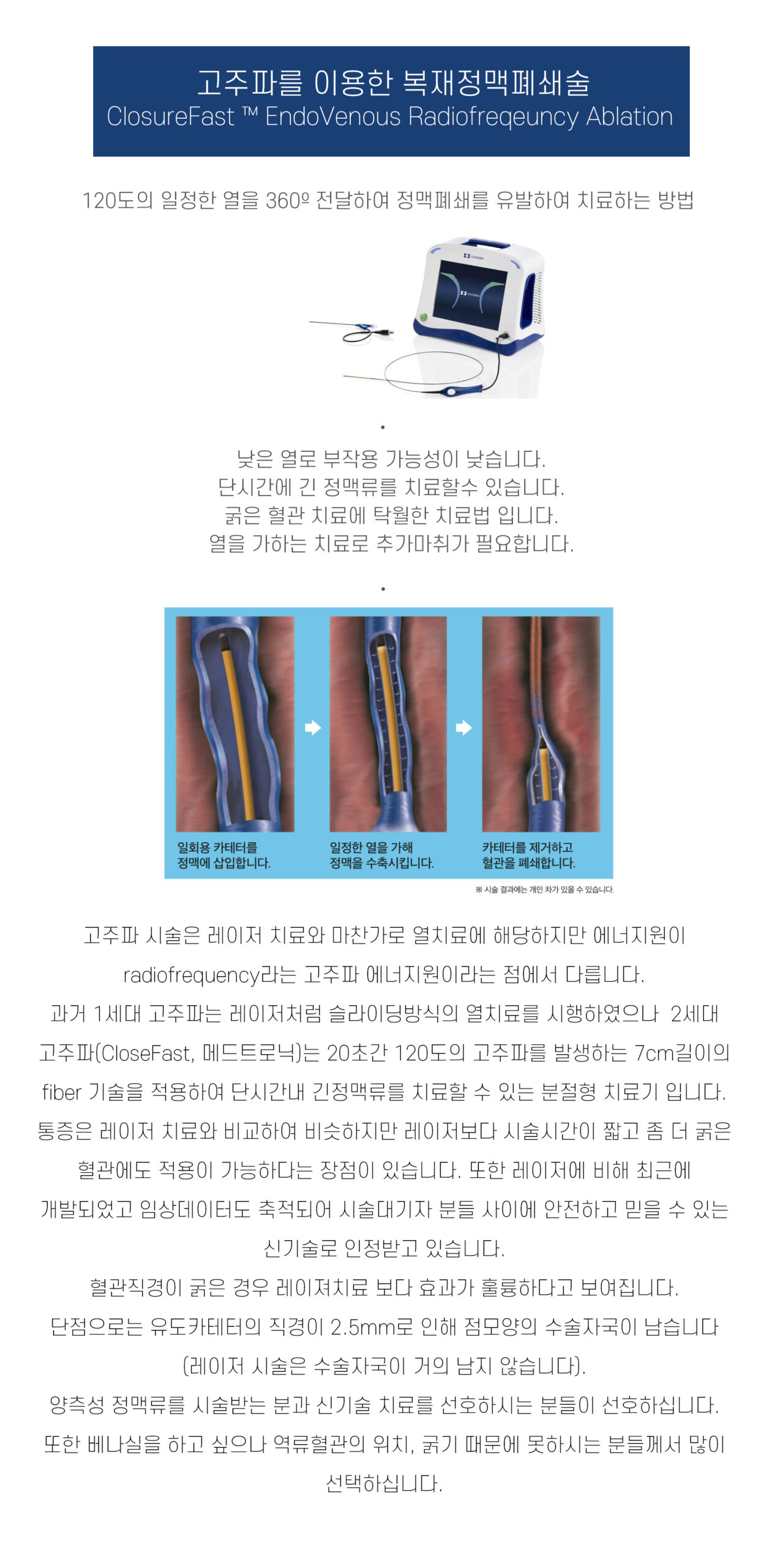 고주파