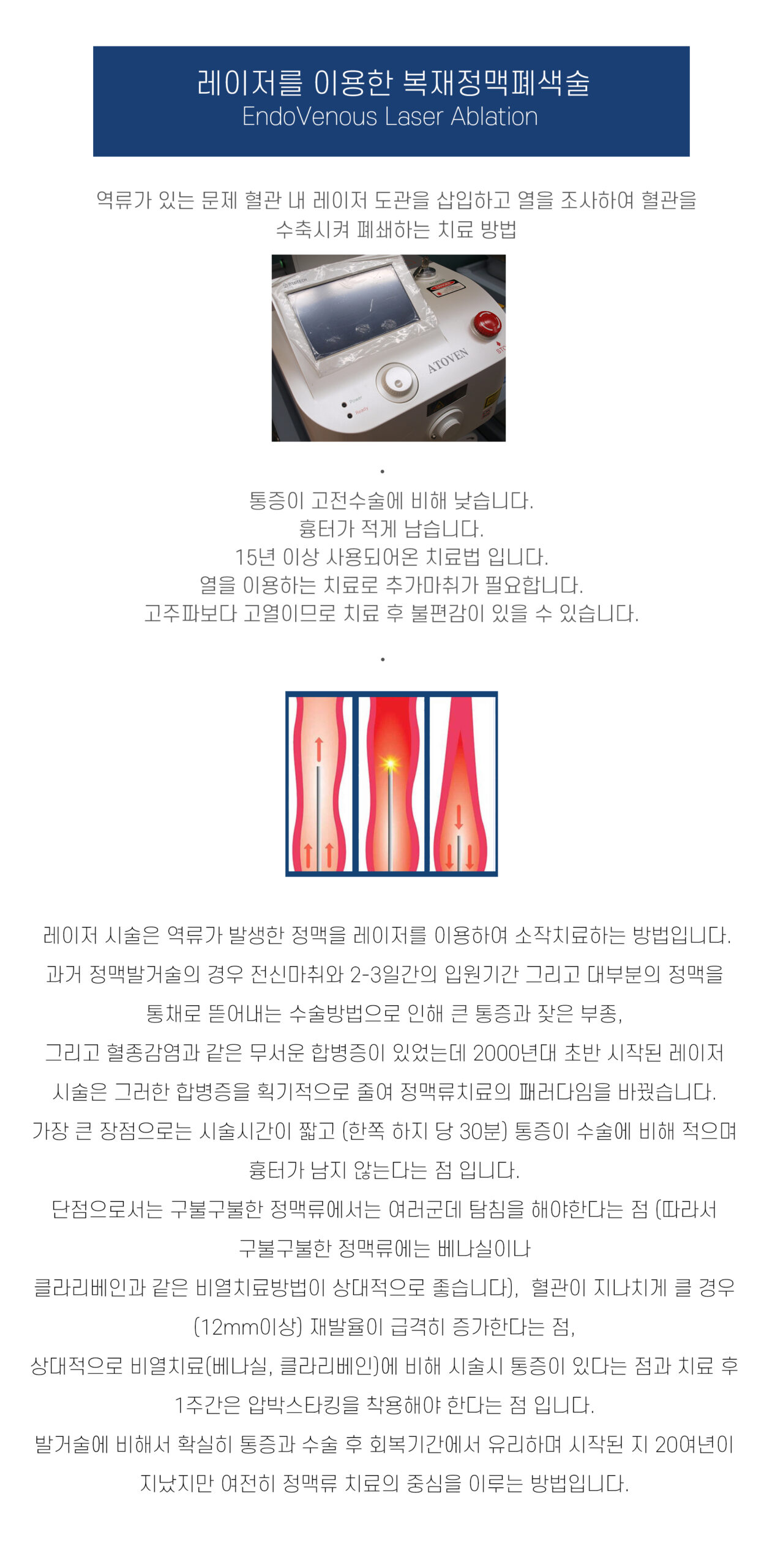 레이저